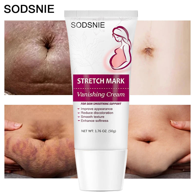 Stretch Mark Vanishing Cream Remove Body Buttock Breast Marks Effective Treatment Repair Maternity Loose Firming Skin Care 50g