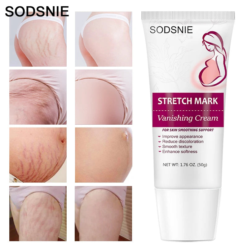 Stretch Mark Vanishing Cream Remove Body Buttock Breast Marks Effective Treatment Repair Maternity Loose Firming Skin Care 50g