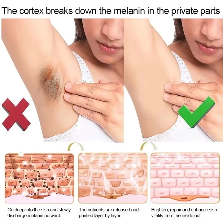 Body Whitening Cream Arms Thighs Underarm Knees Whitening Essence Cream Brighten Moisturizing Body Korean Skin Care Products