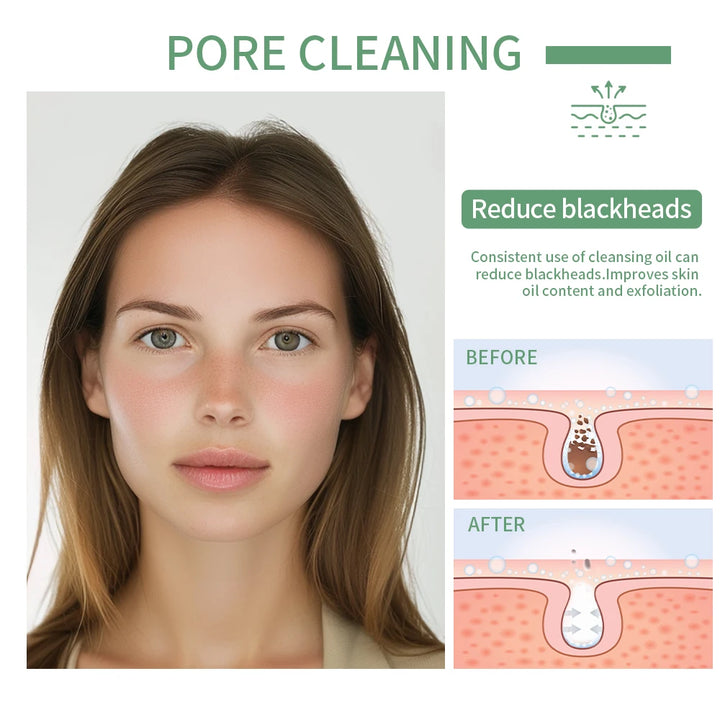 Deeply Cleansing Oil Instant Makeup Removal Refreshing Non Irritating Removal Cleansing Oil Sensitive Skin Care