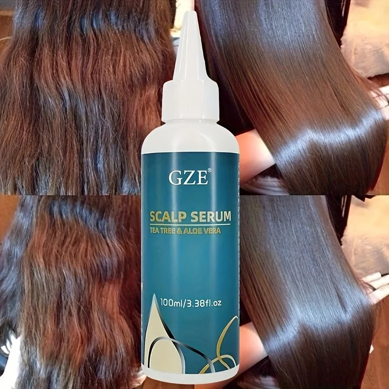 GZE Scalp Serum With Tea Tree & Aloe Vera Leave-In Conditioner Remove loose dandruff flakes For Dry Scalp for Women and Men