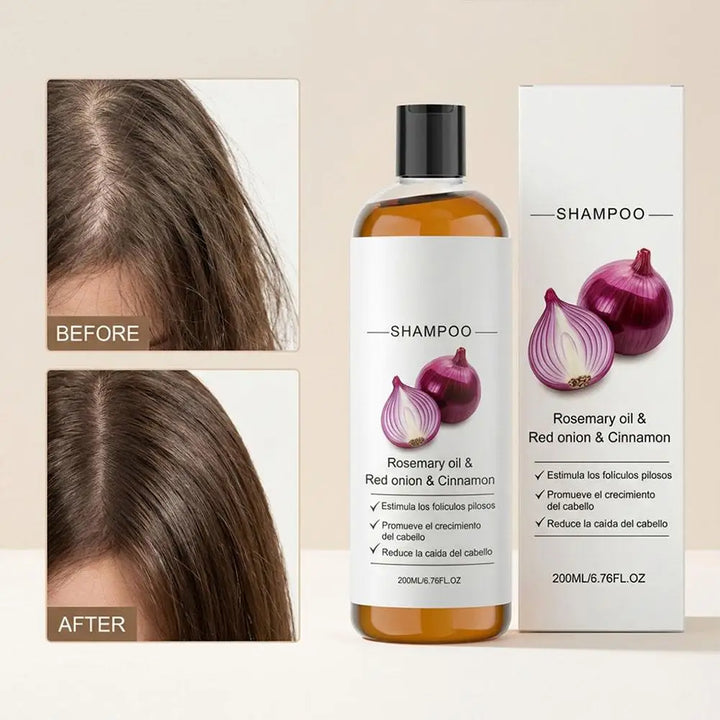 Rosemary Red Onion Shampoo/Conditioner Anti Hair Loss Promote Thicker Stronger excalvo Shampoo/Conditioner Hair Care