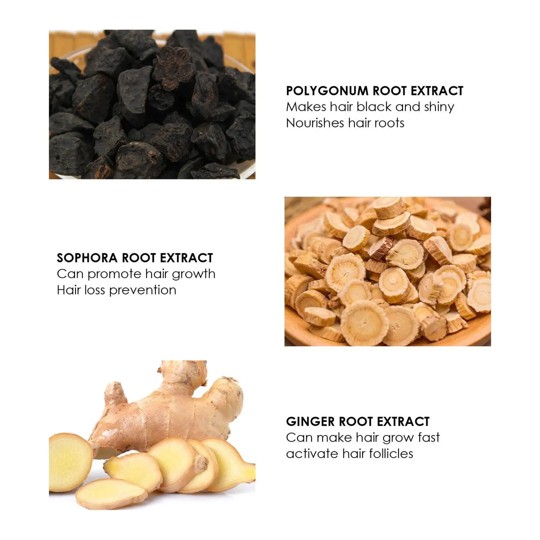 Anti-Hair Loss Serum Thinning Balding Treatment Oil Strengthen Hair Roots For Scalp Health Care Essence 20/30ml