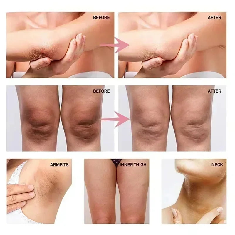 Body Whitening Lotion Dark Spot Remover For Underarms Knees Elbows Melanin Bleaching Lightening Skin Moisturizing Cream