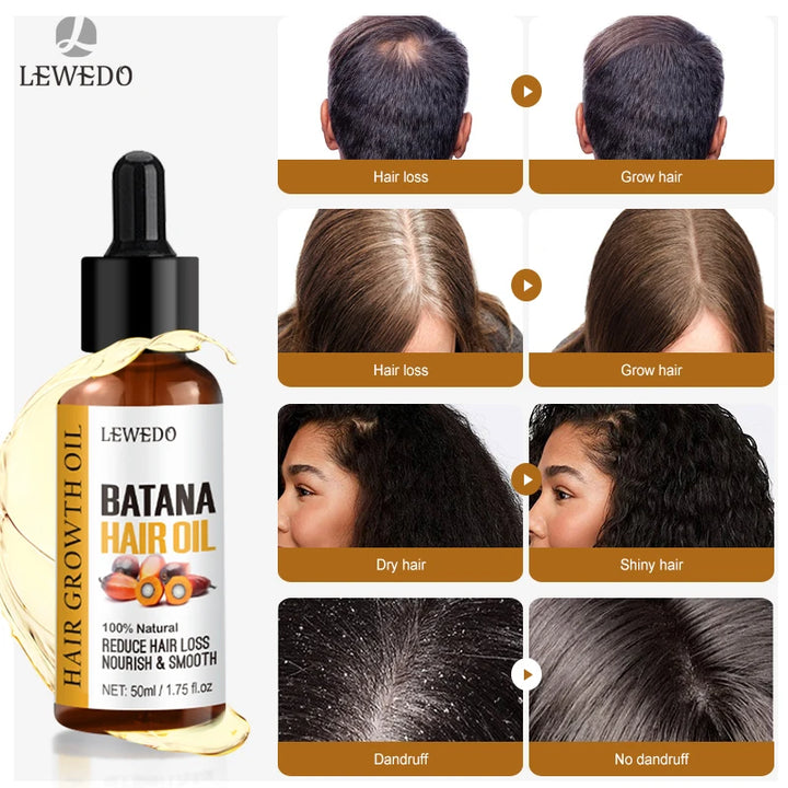 Hair Growth Batana Oil Serum Fast Growing Hair Essential Oil Beauty Hair Care Anti-Hair Loss Essence Natural Repair Damaged Hair