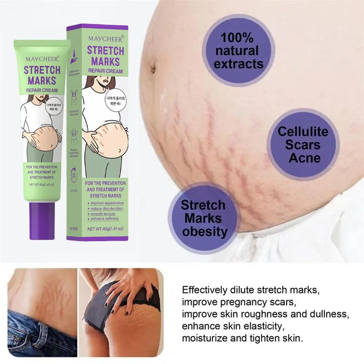 Stretch Marks Repair Cream Fade Lines Improve Duliness Tightness Long-lasting Moisturizing Smooth Enhance Elasticity Body Care
