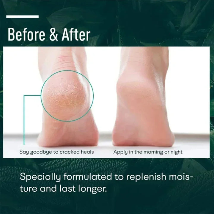 Herbal Anti Crack Foot Cream Heel Cracking Repair Products Exfoliation Dead Skin Removal Softening Moisturize Smooth Skin Care