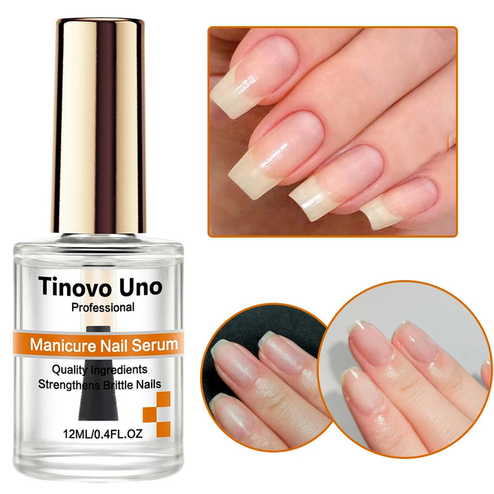 Tinovo Uno Keratin Coconut Nail Strengthening Oil Nail Art Treatment Care Nail Growth Cuticle Oil 12ML Vitamin C Enriched Polish