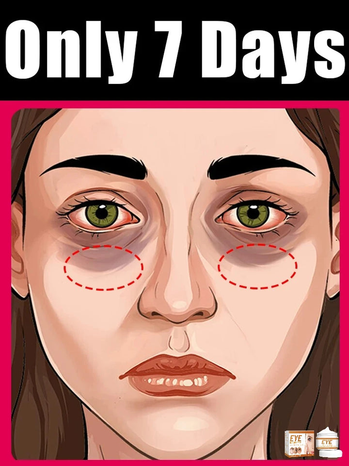 selling wrinkle removing eye cream, eye bags, dark circles, anti swelling, firming, brightening, fine lines, moisturizing tool