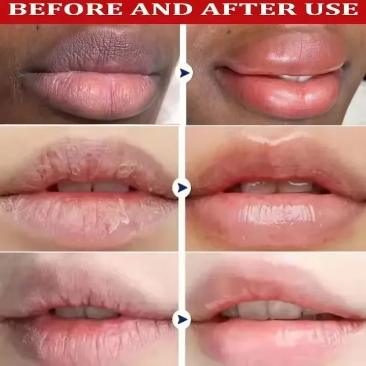 Fast Lighten Melanin Lip Mask Remove Dark Lip Balm Serum Exfoliating Fade Lip Lines Dead Skin Nourishing Repair Lip Care Makeup