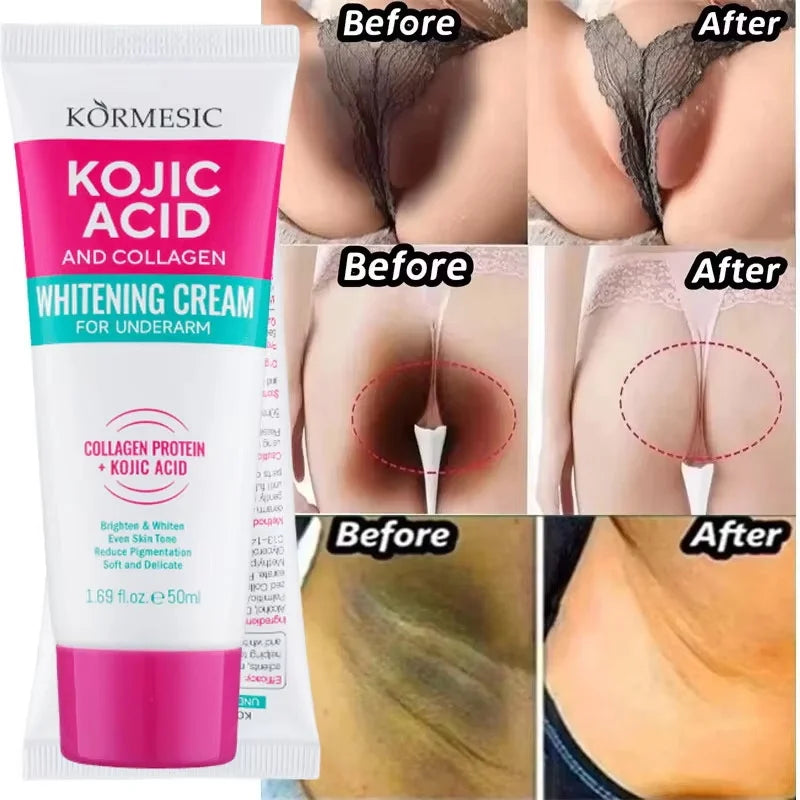 Body Whitening Lotion Dark Spot Remover For Underarms Knees Elbows Melanin Bleaching Lightening Skin Moisturizing Cream
