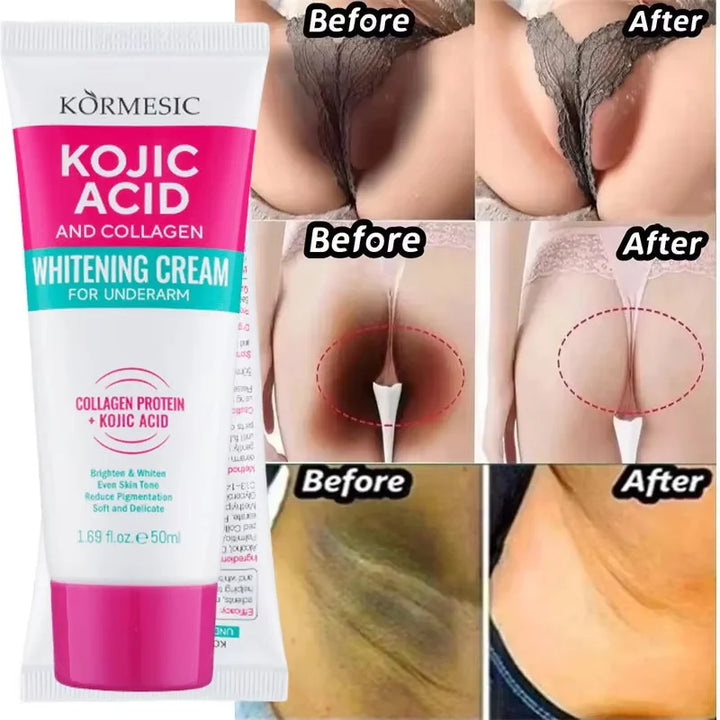 Body Whitening Lotion Dark Spot Remover For Underarms Knees Elbows Melanin Bleaching Lightening Skin Moisturizing Cream