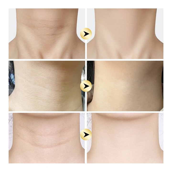 AH-8 Firming Lifting Neck Cream Deep Moisturizing Firms Neck Loose Skin Roller Design Smooth Fine Lines Wrinkles Neck Cream