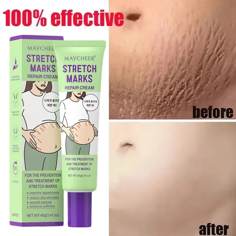 Stretch Marks Repair Cream Fade Lines Improve Duliness Tightness Long-lasting Moisturizing Smooth Enhance Elasticity Body Care