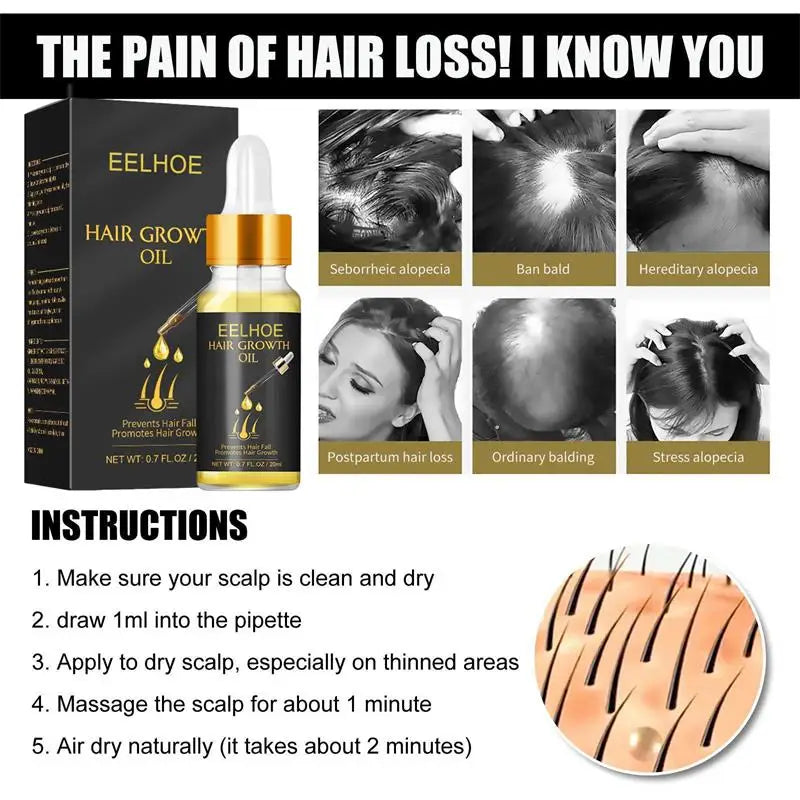 Fast Hair Growth Serum Hair Regrowth Essential Oil Anti Hair loss Repair Damaged Scalp Women Men Anti Baldness Hair Growth Care