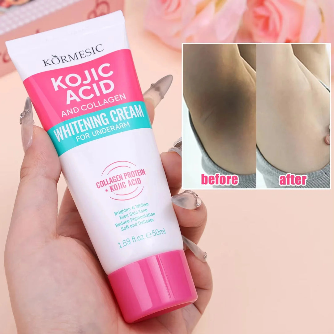 Body Whitening Lotion Dark Spot Remover For Underarms Knees Elbows Melanin Bleaching Lightening Skin Moisturizing Cream