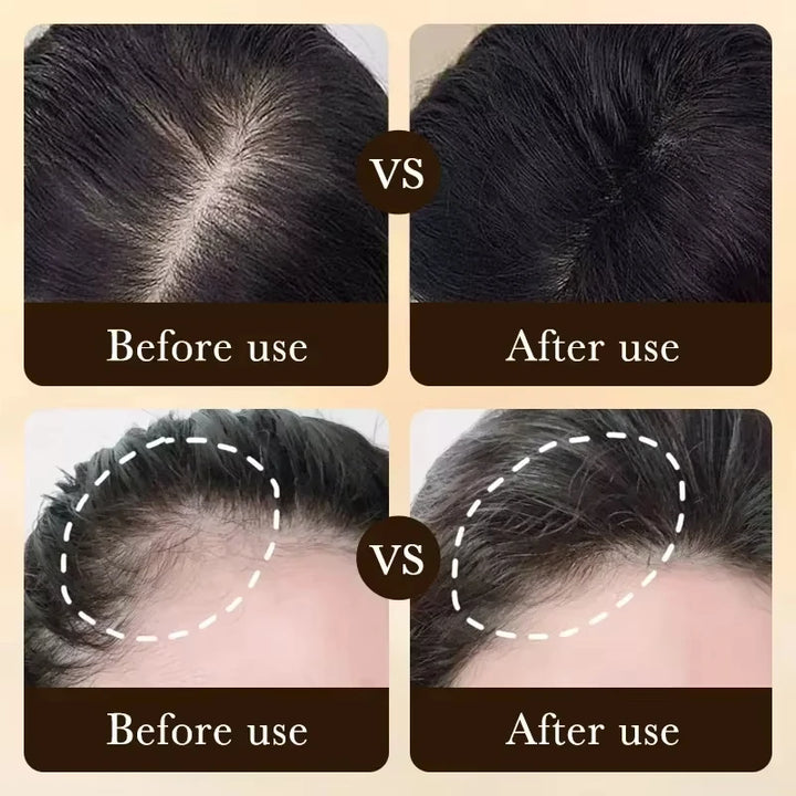 Hair Growth Essential Loss Regrowth Treatment Strengthens Hair Nourishes Scalp Light Weight Non Greasy Improve Scalp Circulation