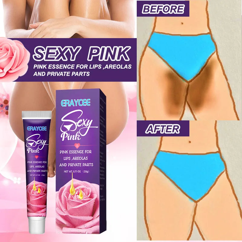 Brightening Cream For Intimate Parts Body Knees Remove Dull Pigments Brighten Serum Elbows Knuckles Lightening Skin Care Product