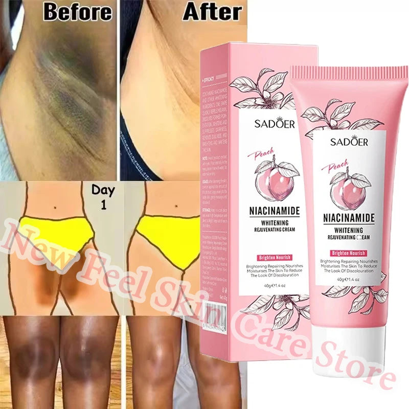 Remove Melanin Nicotinamide Brightening Cream For Dark Skin Effective Lighten Thigh Inner Bleach Private Parts Brighten Cream
