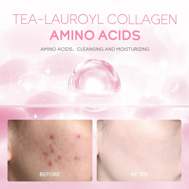 Sakura Facial Cleanser Moisturizing Brightening Acne Removal Oil Control Face Wash for Women& Men 50g Sakura Foam Cleanser Set