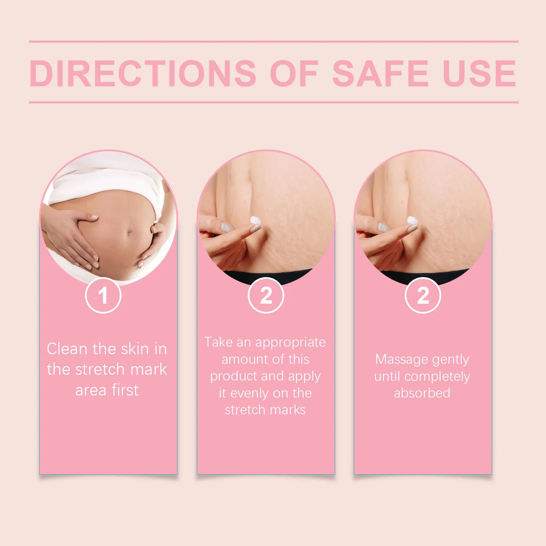 Stretch Mark Cream Postpartum Treatment Improves Firming Effective Removes Growth Lines Obesity Women Pregnant Mark Care Lotion