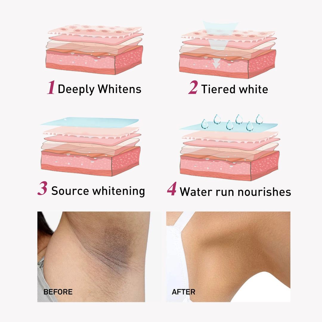 EELHOE 60ml Underarm Whitening Cream Dark Skin Improve Melanin Pigmentation Bleaching Brighten For Underarms Knees Elbows Care