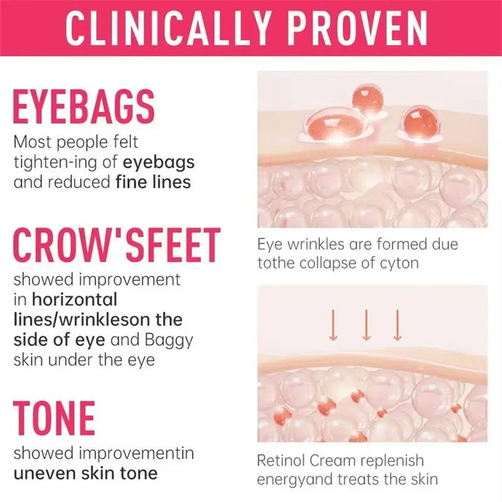 Instant Eye Bag Remove Cream Retinol Anti-Wrinkle Firming Skin Fade Fine Lines Anti Dark Circle Puffiness Brighten Eye SkinCare