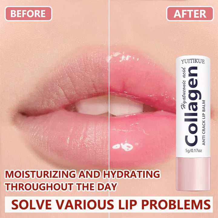 YUITIKUE Collagen Anti Crack Lip Balm | With Hyaluronic Acid | Moisturizing Care For Soft Luminous Lips Easy To Absorb 5g