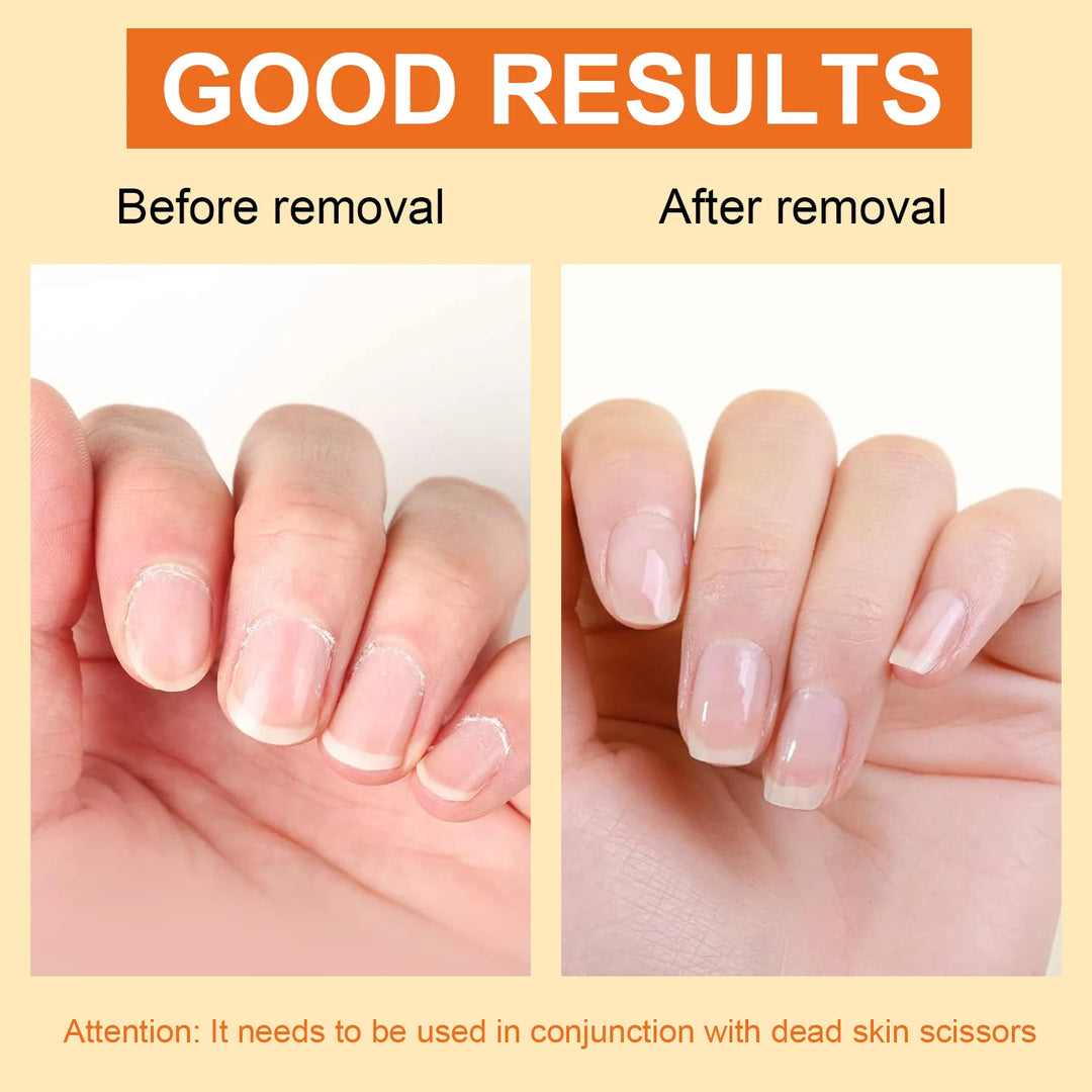 15ml Cuticle Softener Remover Cream For Hand And Foot Nail Care Moisturizing , For Cuticle Dead Skin,Dry Manicures,Brittle Nail