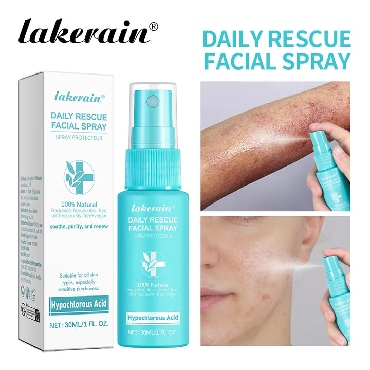 Hypochlorous Acid Spray Toner for Face Helps Reduce Redness Breakouts Soothing pH Balancing Toner Skincare