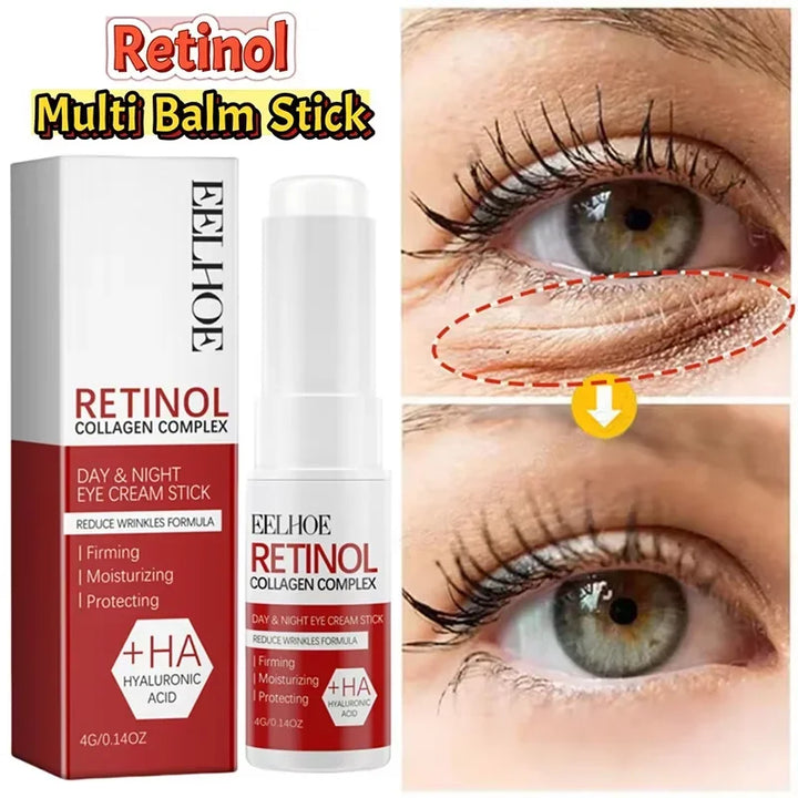 Retinol Eye Cream Collagen Multibalm Stick Reduce Wrinkles Eye Bag Hyaluronic Acid Anti Dark Circle Puffiness Eye Care Products