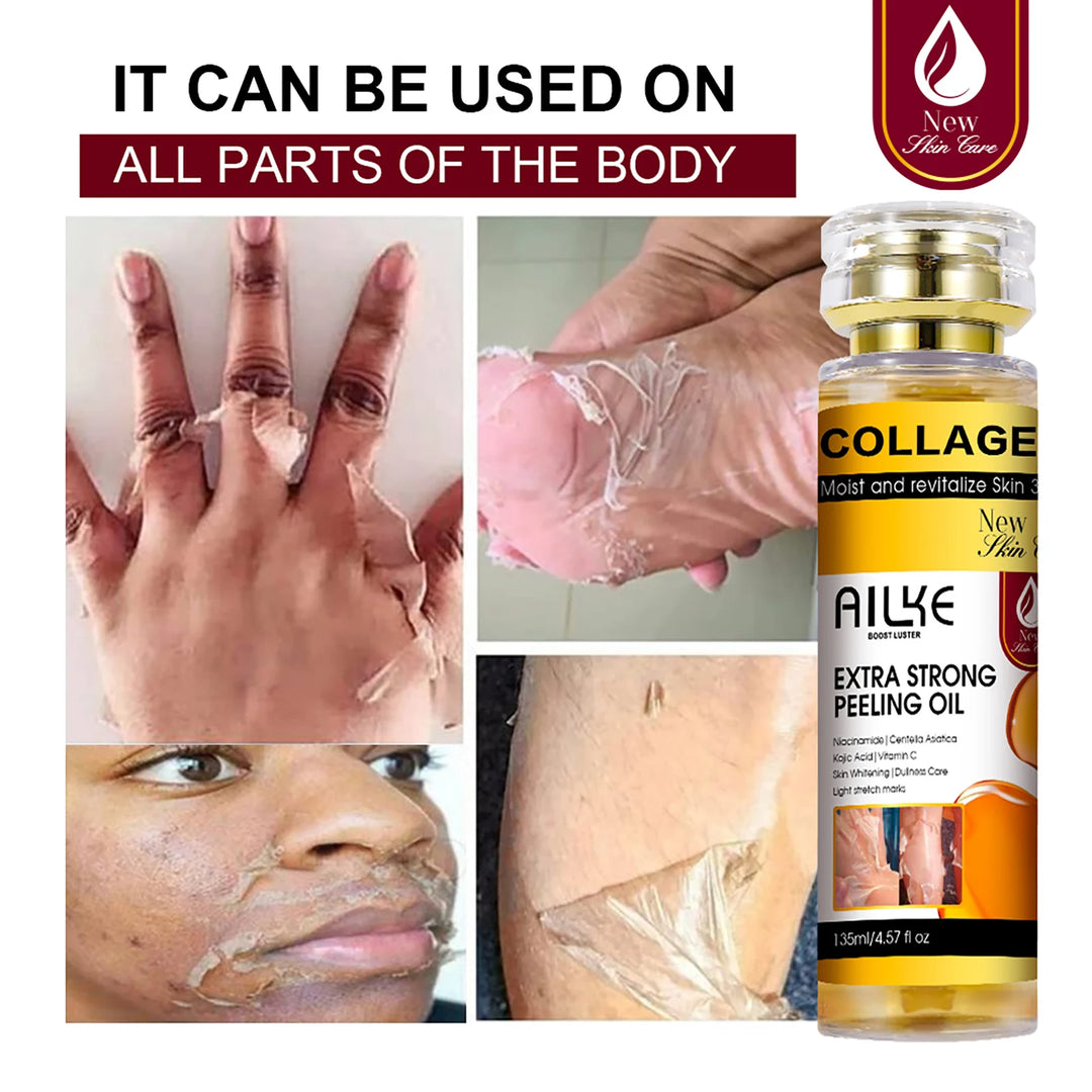 AILKE Collagen Extra Strong Peeling Oil, Whitening Skin, Exfoliating Solution for Face, Body, Hand, Feet, for All Skin Types