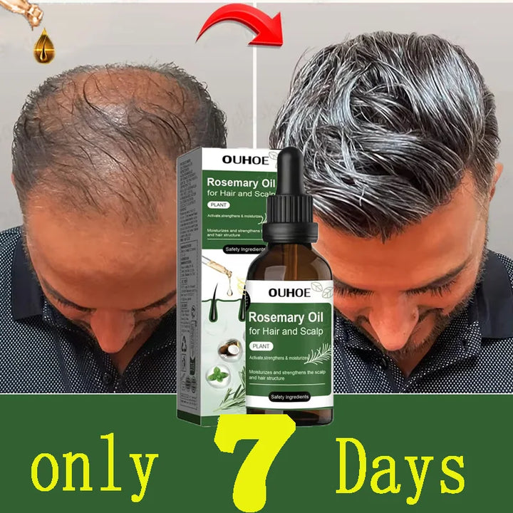 Rosemary Hair Growth Oil Anti Hairs Loss Treatment Mint Hair Strengthening Oil Nourishing Roots Regrowth Hair For Men Women 50ml