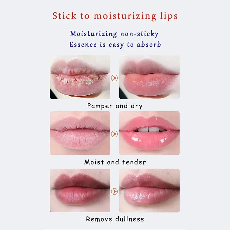 Remove Dark Lighten Lip Balm Exfoliating Dead Skin Anti-Crack Fade Lip Line Moisturizing Brighten Repair Lip Care Products