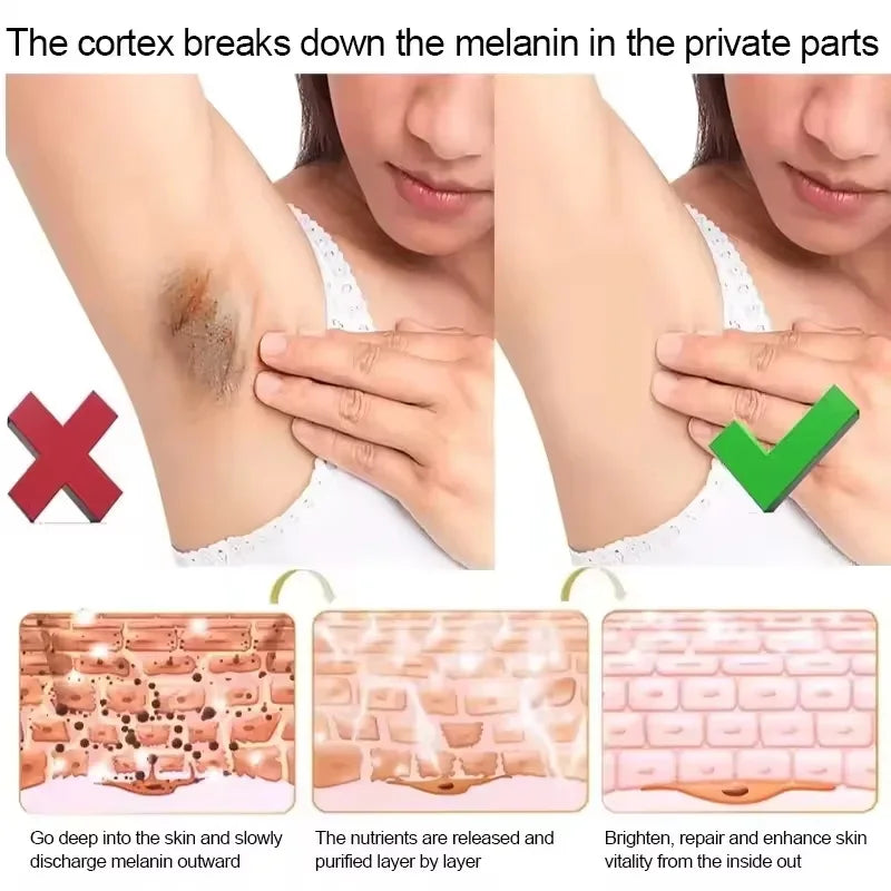 Body Whitening Bleach Cream Brighten Underarm Elbow Knees Joint Removal Intimate Parts Dark Spots Melanin Snow Bleach Cream