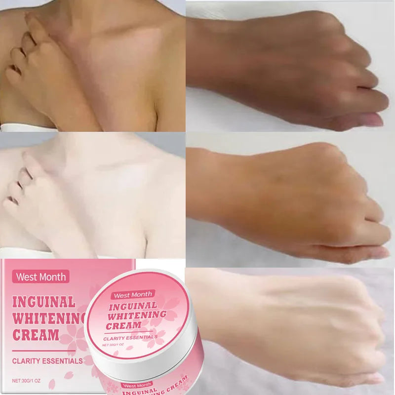 Niacinamide Body Whitening Cream For Underarm Bleaching Armpit Lightening Intimate Area  Moisturizer Korean Skin Care Product