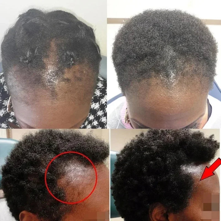 Batana Hair Growth Oil Conditioner Anti Hair Loss Products Fast Growing Hair Mask Nourishing Repair Roots Hair Care for women