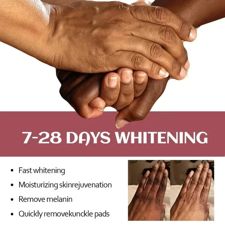 Fast Whitening Hand Cream Dark Knuckles Brighten Moisturizing Intense Stains Remover Melanin Corrector Products hand Skin Care