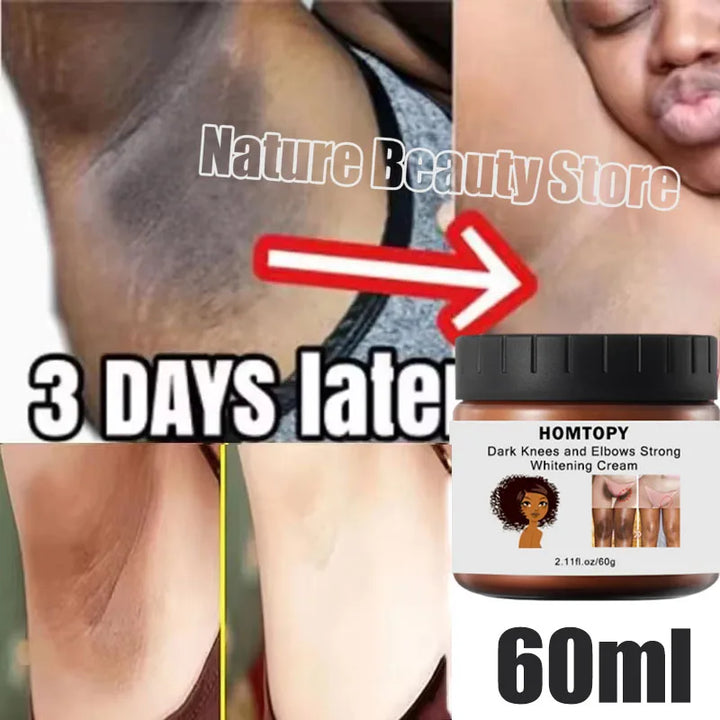 Whitening Cream Private Parts Underarm Bleaching Serum Whiten Butt Knee Brighten Inner Thigh Intimate Parts Dark Remove Melanin