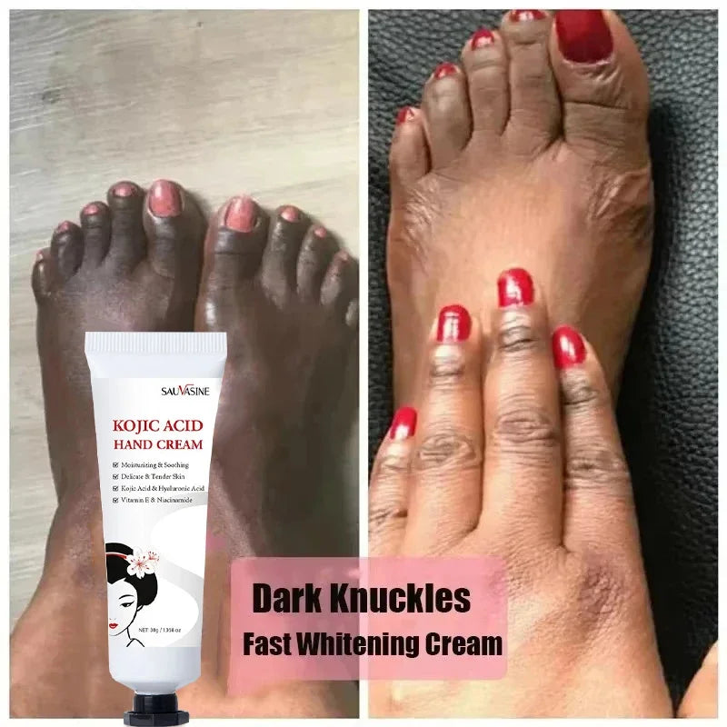 Dark Knuckles Fast Brighten Cream Elbows Hand Knuckle Brightening Serum Knee Black Skin Quickly Lighten Stains Remover Essence