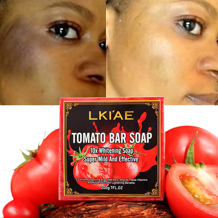 LKIAE Brand Tomato Fruit Scented Handmade Natural Bar Soap, For Face, Body, Whitening, Oil Control, Brightens, Shrink Pore, 200g