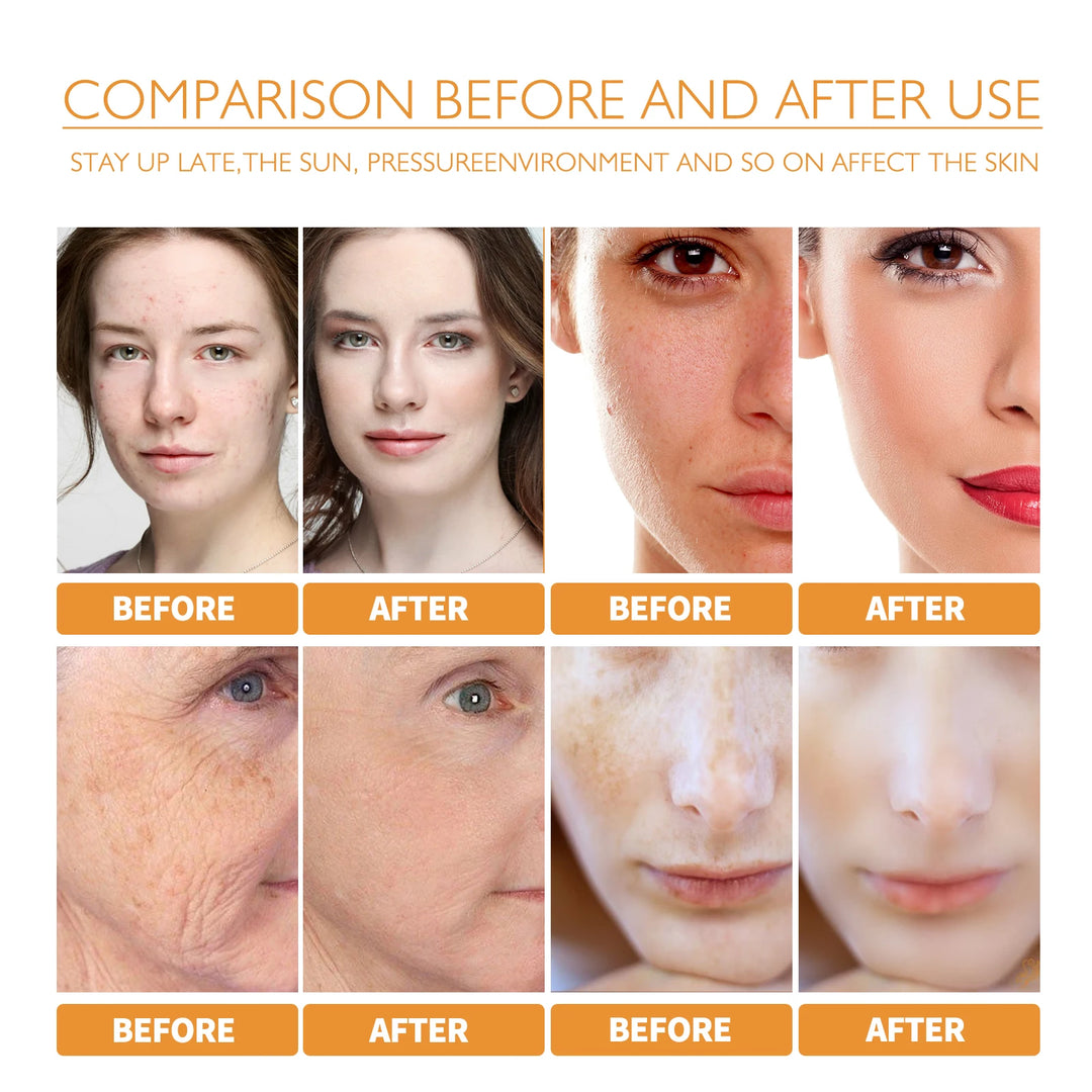 WEST MONTH Turmeric Anti-Oxidation Face Serum Creamy Easy-To-Use-Absorbent Texture Restore Skin Elasticity Hydration 30ml