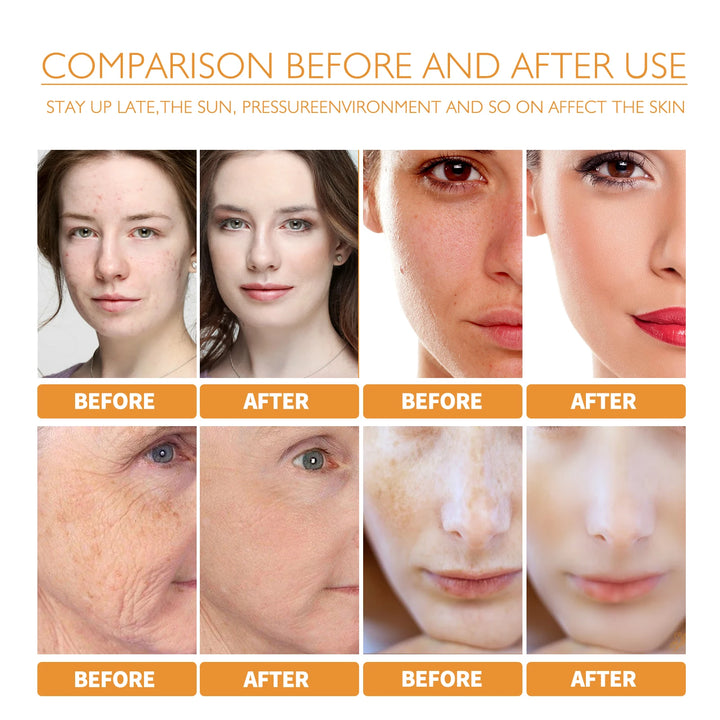 WEST MONTH Turmeric Anti-Oxidation Face Serum Creamy Easy-To-Use-Absorbent Texture Restore Skin Elasticity Hydration 30ml