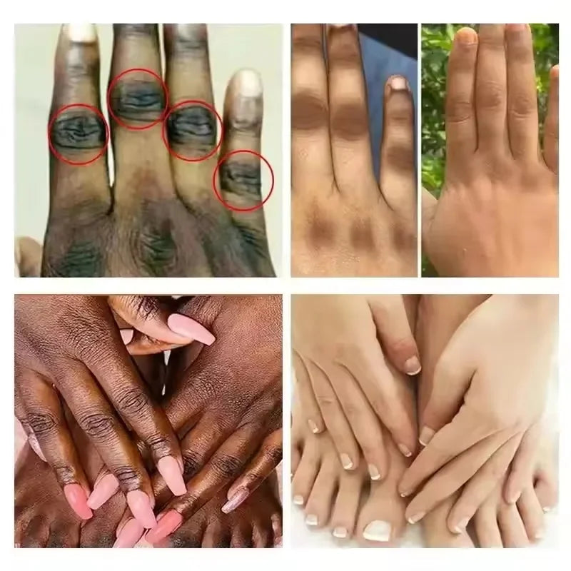 Dark Knuckles Fast Brighten Cream Elbows Hand Knuckle Brightening Serum Knee Black Skin Quickly Lighten Stains Remover Essence