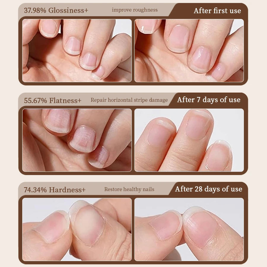 RSNAIL 3-in-1 Cuticle Oil Pen with Ceramic Nail Pusher for Hangnails Dry & Damaged Nails -Nail Care Pen for Repair & Nourishment