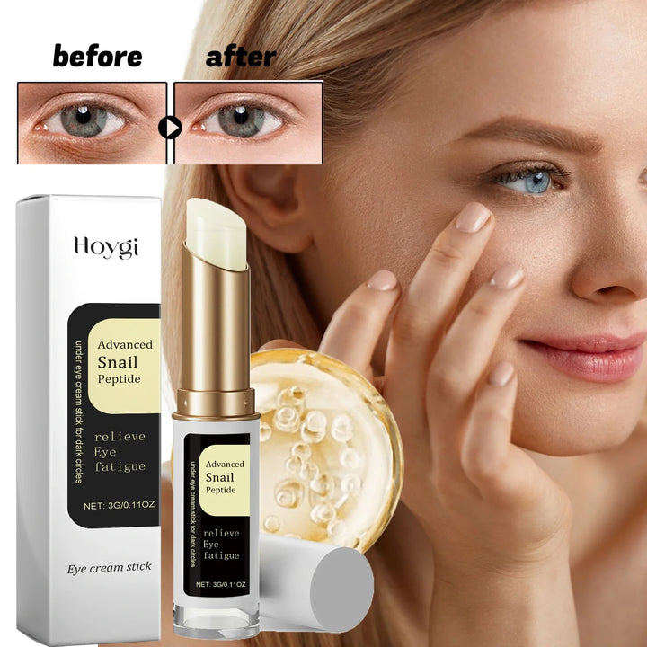 Snail Peptide Eye Cream stick reduce Dark Circles Eye Bags Firming Brightener Anti aging nourishing moisturize Eye Cream
