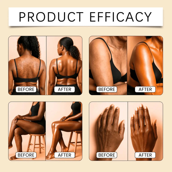 Moisturizing Body Oil with Vitamin E Camellia Oil Deep Hydration for Dry Skin Winter Skincare Anti Dryness Holiday Gift 100ml