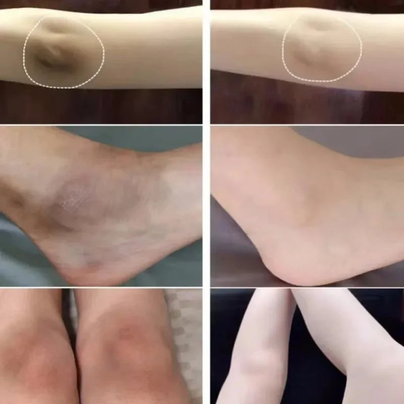 Body Whitening Cream Arms Thighs Underarm Knees Whitening Essence Cream Brighten Moisturizing Body Korean Skin Care Products New