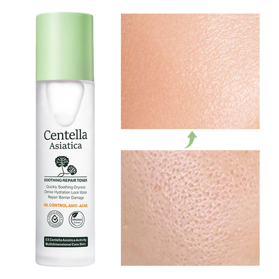 Centella Toner Centella Asiatica Soothing Face Anti-Aging Pore Control Hyaluronic Acid Lifting Facial Serum Centella water 30ml