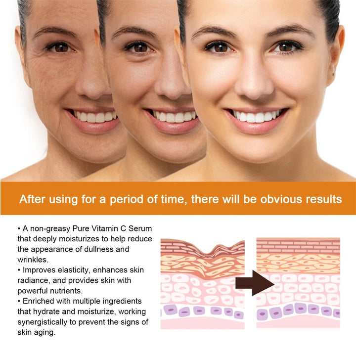 Vitamin C Whitening Serum Effective Remove Dark Spots Freckles Fade Melanin Anti-Wrinkle Brightening Nourishing Face Skin Care